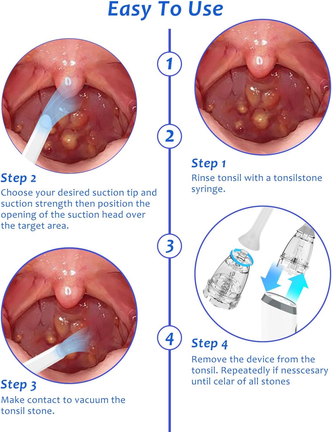 8 Suction Modes 3 Levels Tonsi - Learn Diy Electronics recensione e prezzo